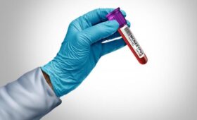 Врачи бьют тревогу: на Европу наступает мутировавший штамм обезьяньей оспы