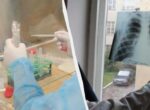 Пробы Манту в Украине больше не будет: чем заменят
