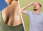 У 3% людей есть эта патология: врач объяснила, как бороться с чрезмерным потовыделением