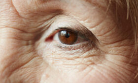 Психиатр назвал 7 ранних признаков деменции и болезни Альцгеймера: на что обращать внимание