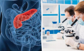 Ученые нашли способ уничтожить до 90 % клеток одного из самых агрессивных видов рака