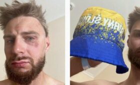 В Чехии избили поляка, которого приняли за украинца из-за цвета его панамки